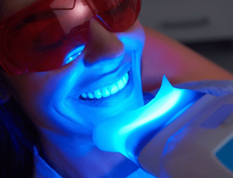 Picture of teeth whitening procedure