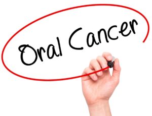 picture of ORAL CANCER SCREENING 